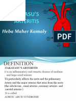 Takayasu's Arteritis HH