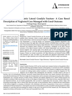 Do Not Miss A Pediatric Lateral Condyle Fracture A Case Based Description of Neglected Case Managed With Good Outcome