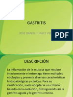 Gastritis