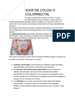 Cancer de Colon o Colorrectal