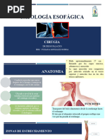 Patología Esofágica