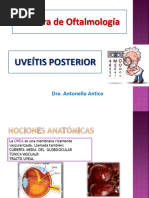 Uveítis Posterior 2021