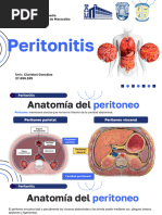 Peritonitis