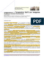 Trombosis Venosas Intracraneanas - RS 231108