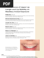 The Influence of Upper Lip Length and Lip Mobility On Maxillary Incisal Exposure