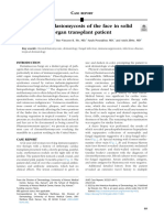 Chromoblastomycosis of The Face in Solid Organ Transplant Patient