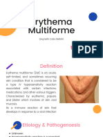 Erythema Multiforme