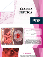 Trabalho Úlcera Péptica