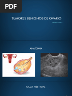 Tumores Benignos de Ovario