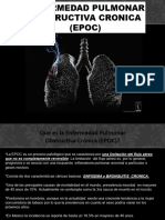 Enfermedad Pulmonar Obstructiva Cronica Epoc