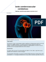 Accidente Cerebrovascular Cerebeloso