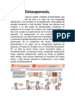 Osteoporosis Articulo Completo