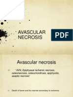 Avascular Necrosis