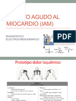 3dx EKG IAM