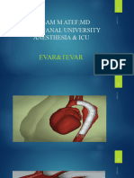 Tevar (Thoracoendovasular Aortic Repair)