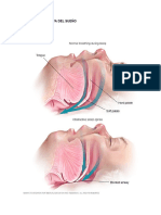 Apnea Obstructiva Del Sueño