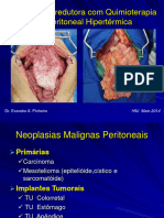 Cirurgia Citorredutora Com Quimioterapia Hipertérmica Intraoperatória