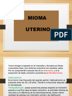 Mioma Uterino R