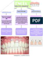 Mapa Conceptual Encía