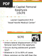 Slipped Capital Femoral Epiphysis