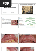 Clase 4 - Biopsia de Mucosa Oral - Diplomado en Medicina Oral