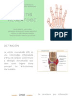 Artritis Reumatoide