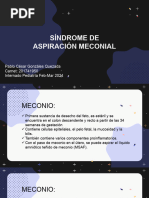 Clase Síndrome de Aspiración Meconial y Taquipnea Transitoria Del RN