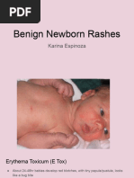 Newborn Rash