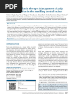 Guided Endodontic Therapy Management of Pulp Canal Obliteration