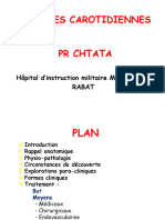 2 Stenoses Carotidiennes