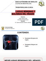 Neoplasias Benignas y Malignas Del Higado