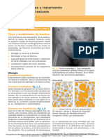 Fracturas y Tratamiento de Las Fracuras