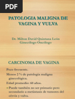 Patologia Maligna de Vagina y Vulva