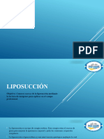 Liposucción