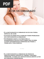 4 Acne en Embarazo