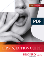 Belotero Lips Injection Guide