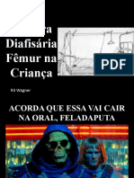 Fraturas Do Femur PED 2019