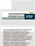 10 Enfermedades Intersticiales