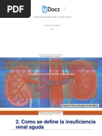 Insuficiencia Renal Aguda