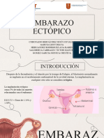 Embarazo Ectopico