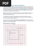 Cómo Interpretar Un Electrocardiograma