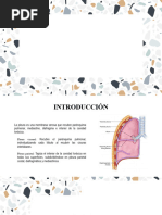 Derrame Pleural