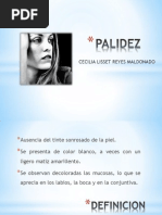 PALIDEZ