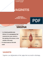 Vaginitis