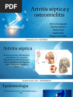 Osteomielitis y Artritis Septica