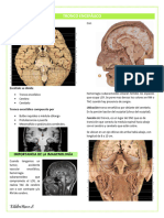 Tronco Encefálico