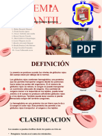 Anemia Infantil