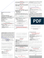 RESUMO - ECG - Arritmias