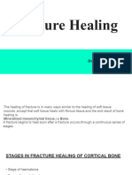 Fracture Healing