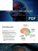 Tumores Cerebrales